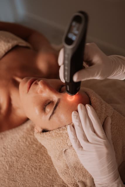 Peeling avançado — tratamento Perfect Peel